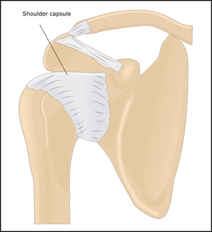 How does shoulder joint instability lead to shoulder dislocations?