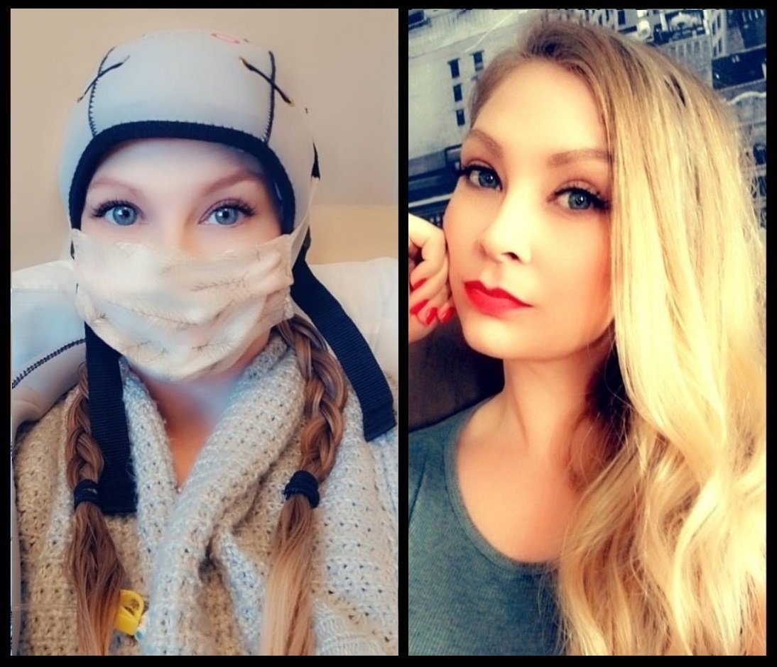 Keeping her hair during chemo helps one breast cancer patient feel ‘in control’