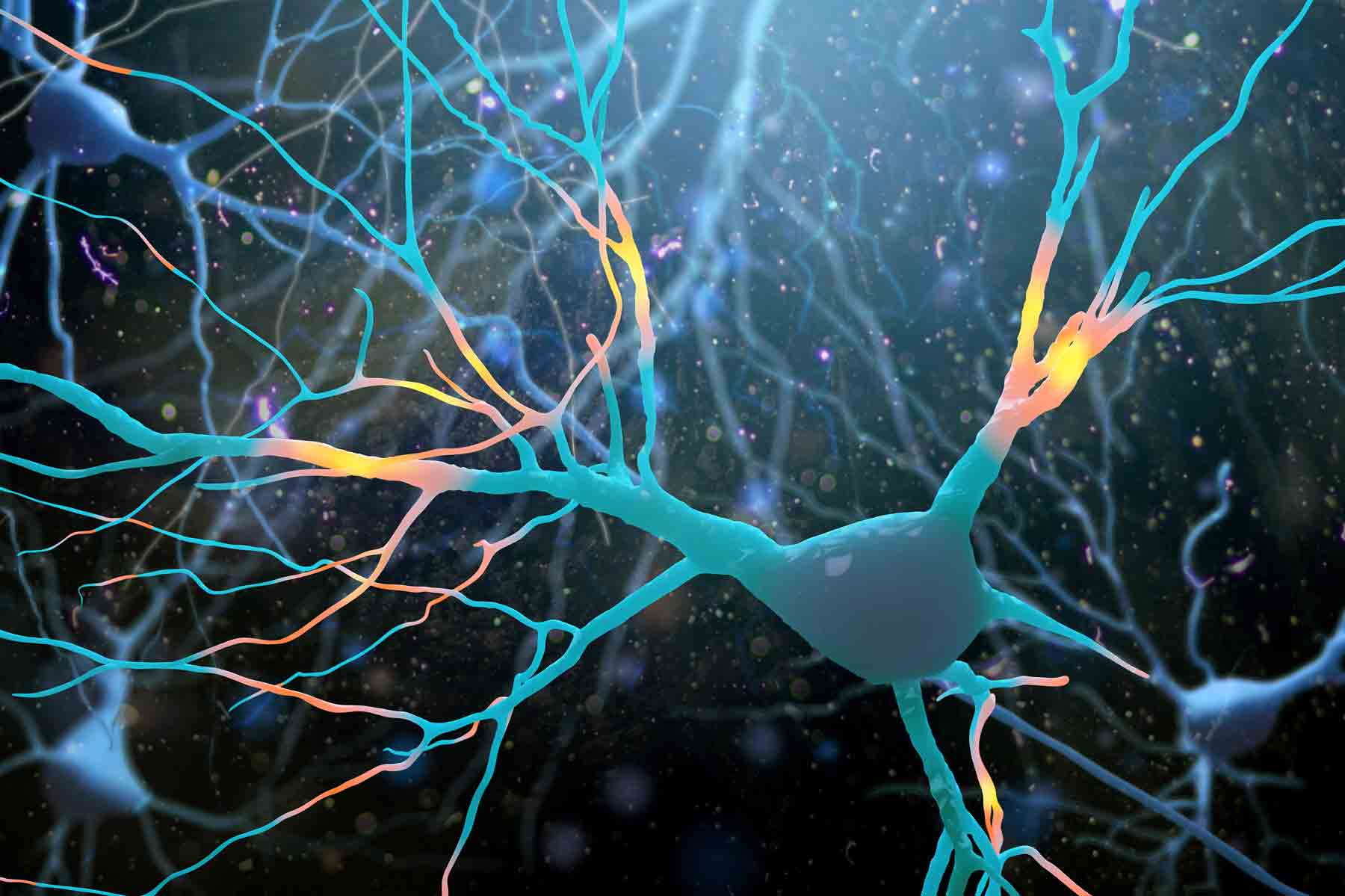 La maladie d’Alzheimer, une maladie neurodégénérative